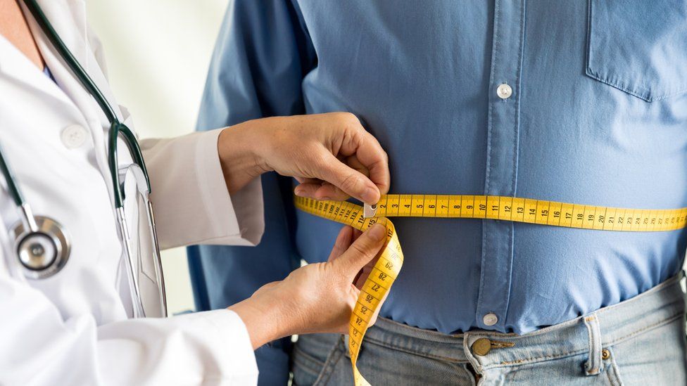Bariatric Surgery