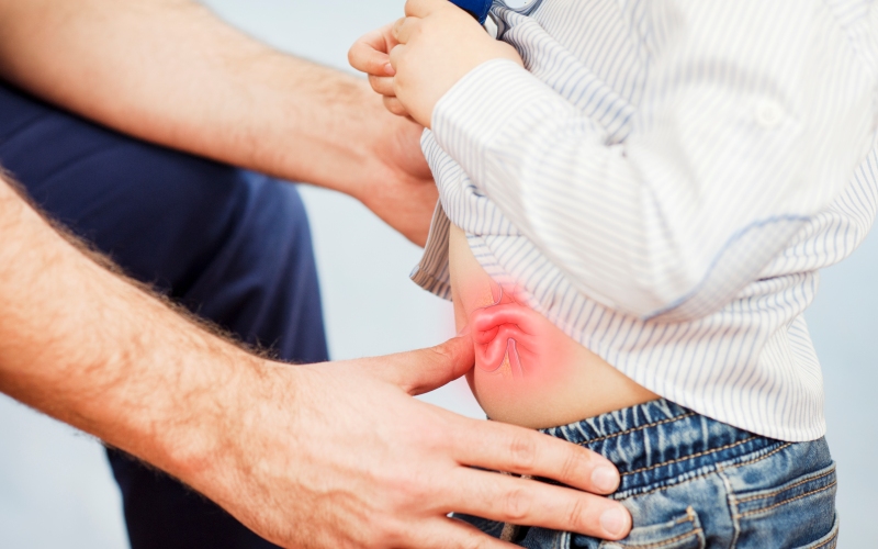 Hernia