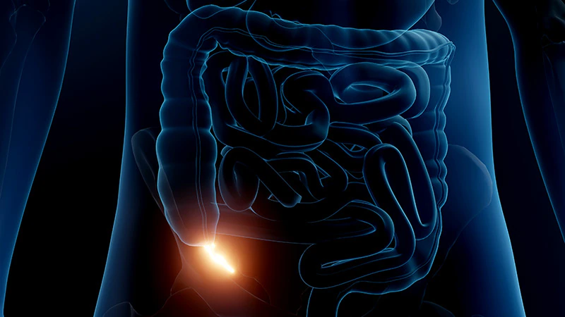 Appendix Surgery