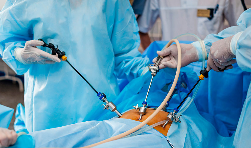 How Long Does It Take to Heal from Laparoscopic Surgery