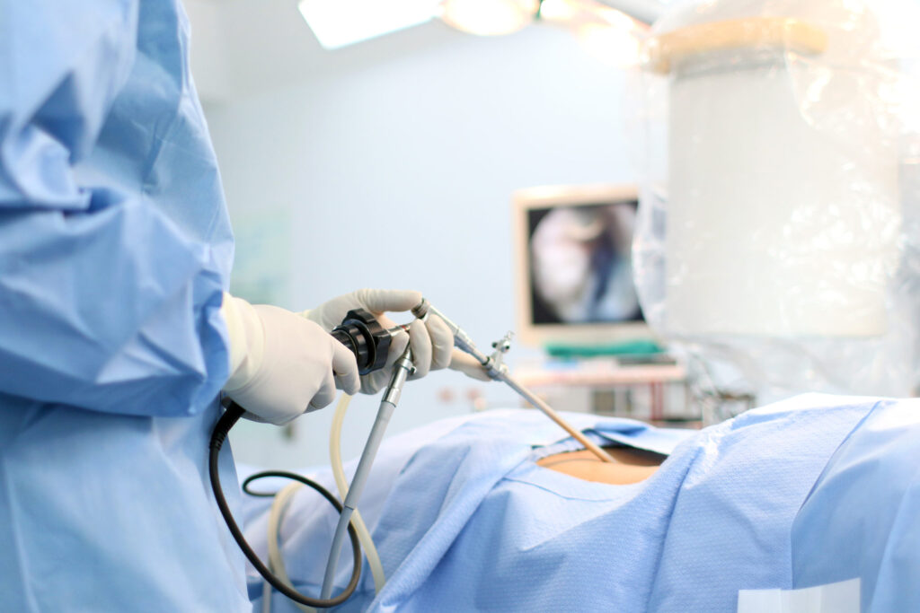 laparoscopic surgery